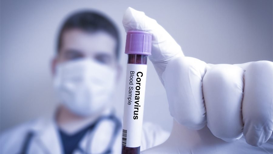 Delhi Covid - 19 Updates: Plasma bank starts today Kejriwal encourages people to donate