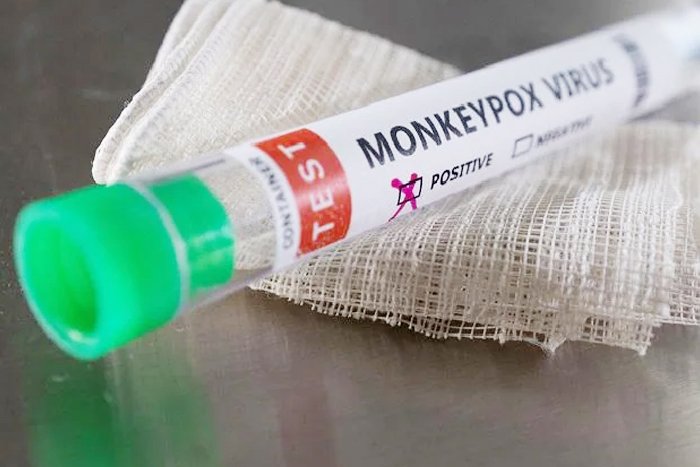 One Contact Of Delhi Monkeypox Patient Complains Of Body Ache, Being Monitored